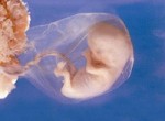 Технология ЭКО и имплантация эмбриона